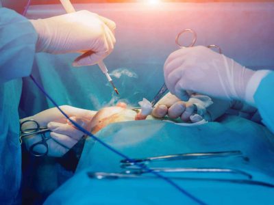 breast-surgery